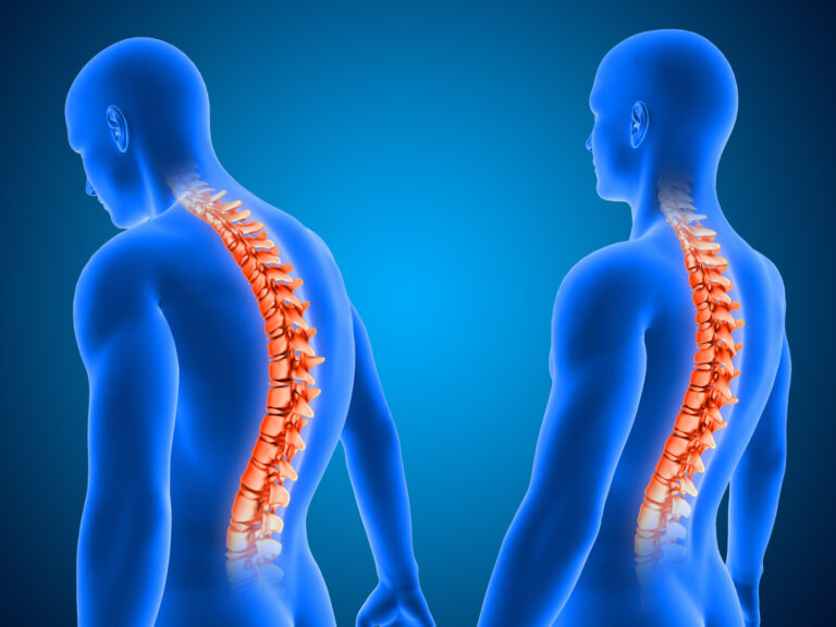 Orthopaedic Backrest